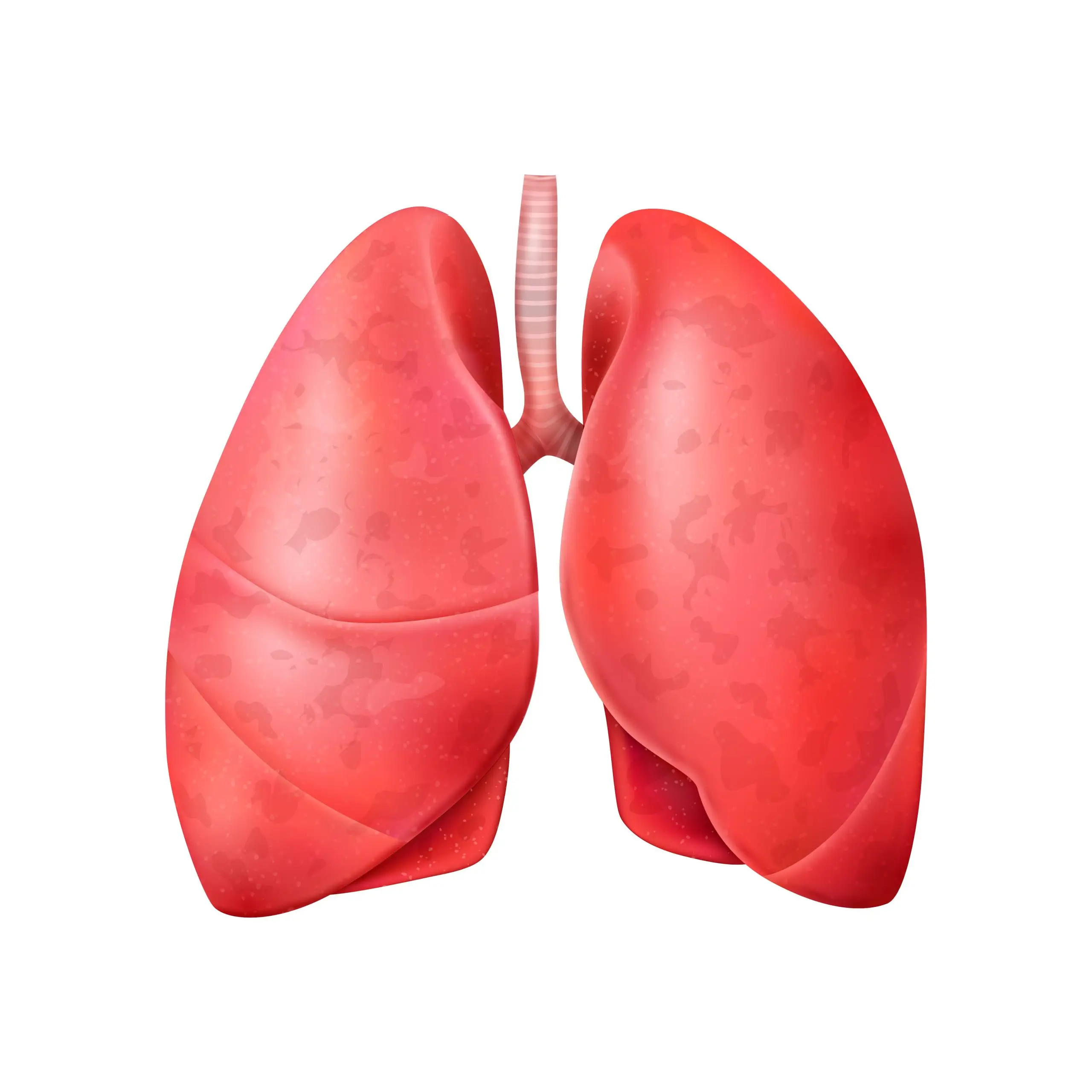 Symptoms of Bronchiectasis