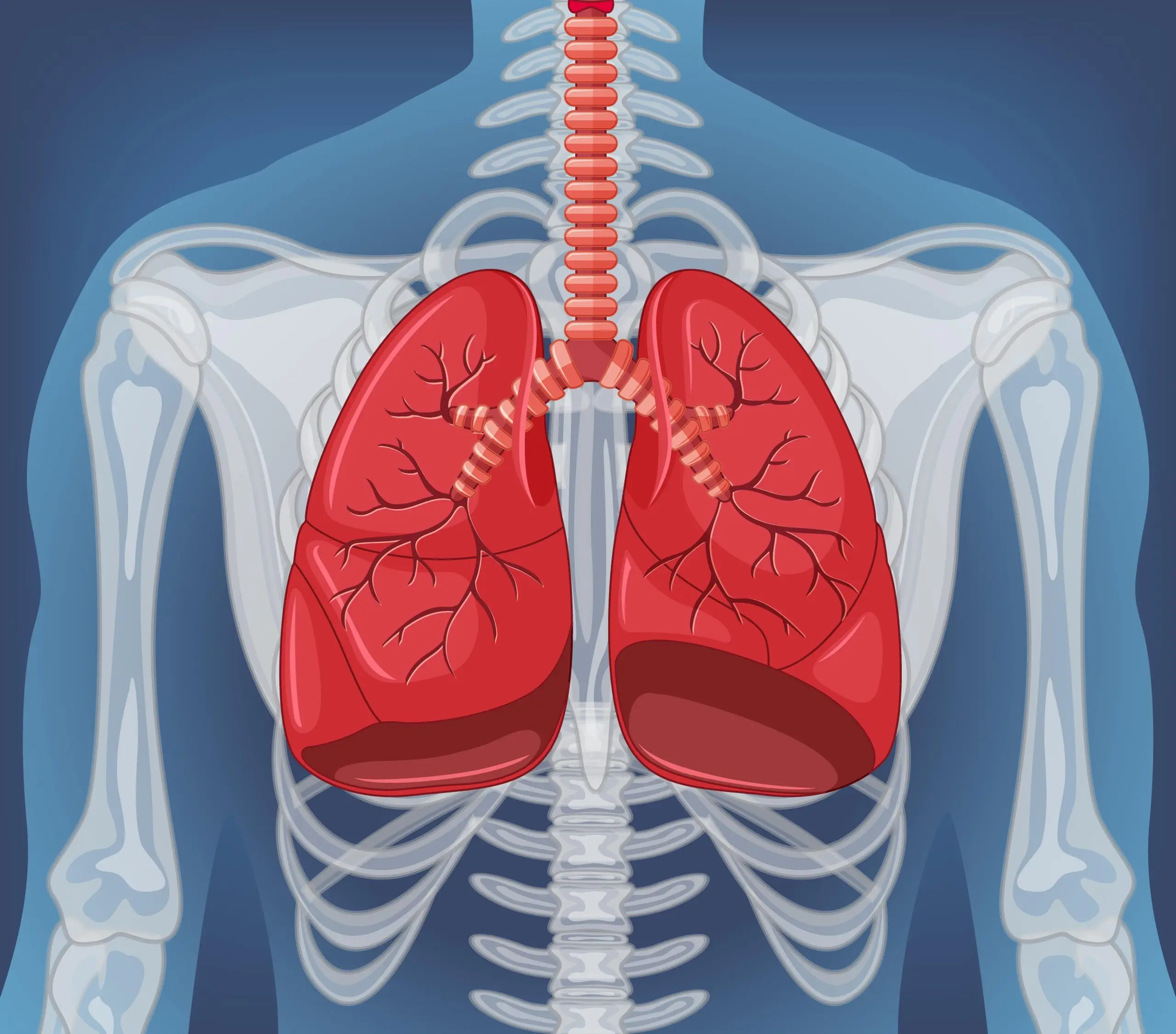 What Causes Lung Collapse? Everything About Lung Collapse in 6 Steps