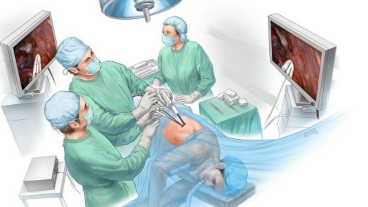 Single Port Thoracoscopy Surgery in Lung Cancer