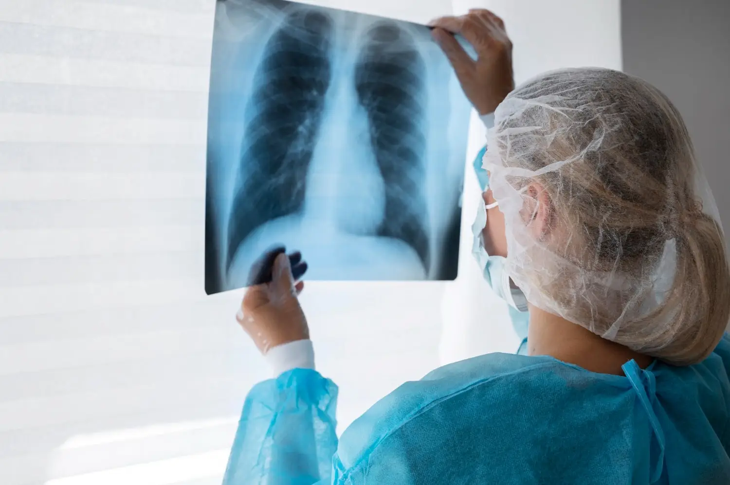 How Long Do Emphysema Patients Live