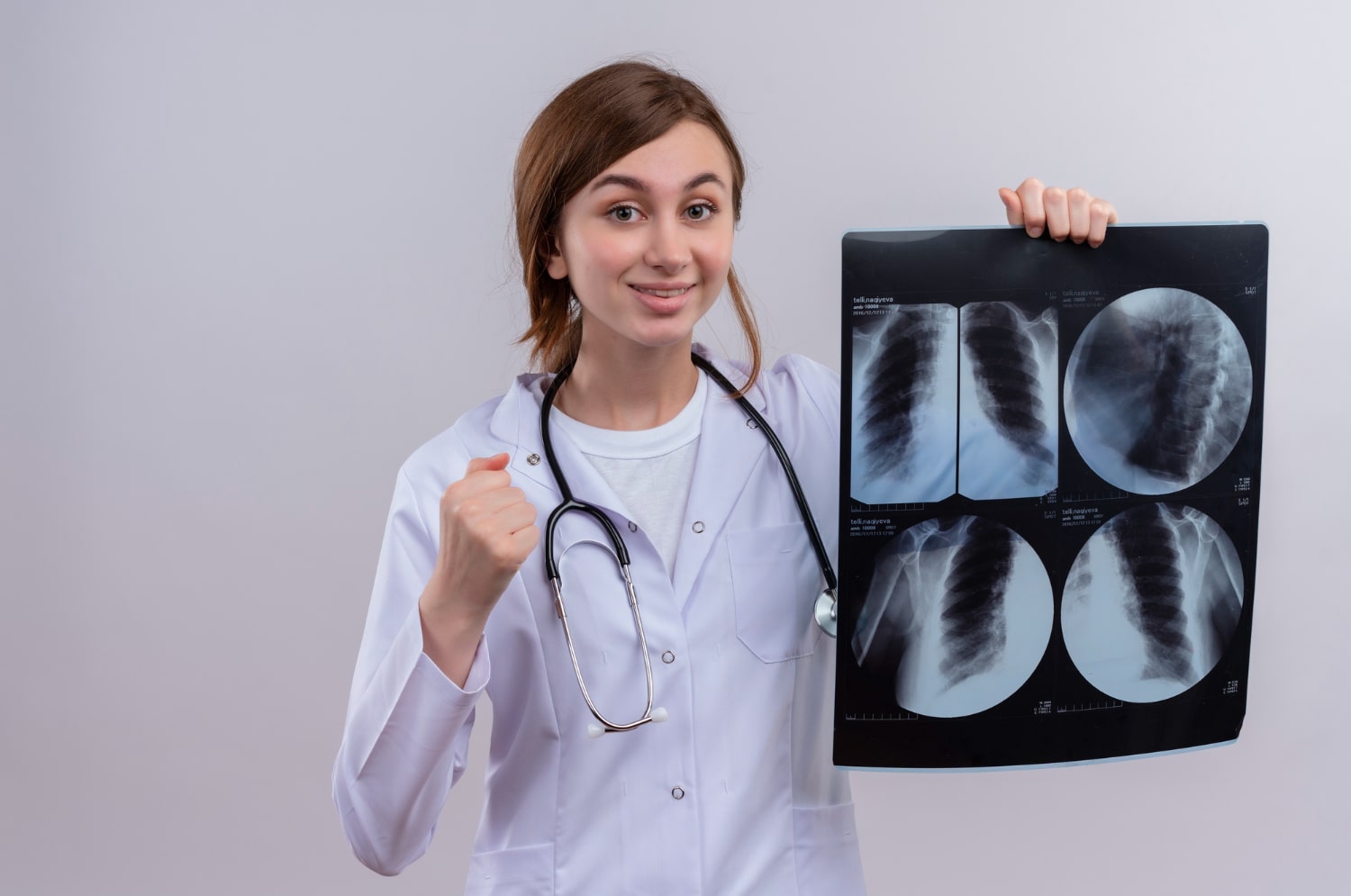 Lung Cancer X-Ray