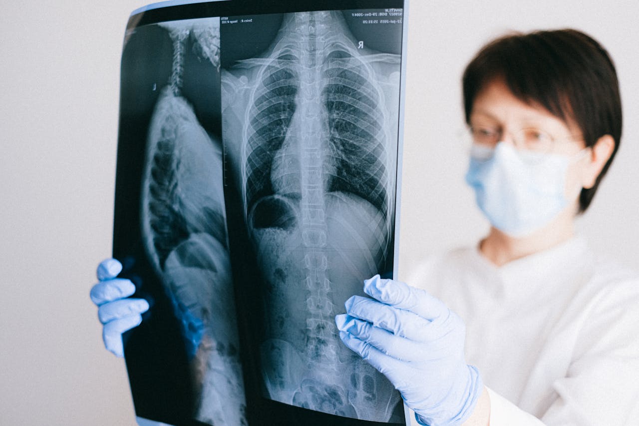 What is Lung Collapse? How is Lung Collapse Treated?