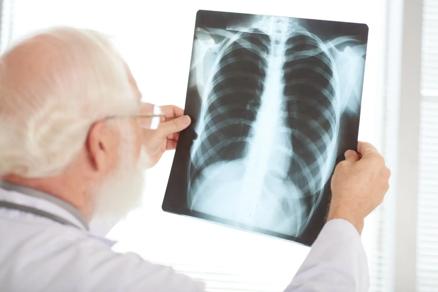 What Causes Lung Collapse